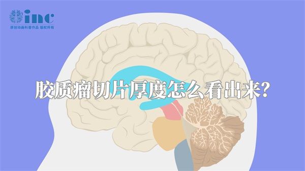 胶质瘤切片厚度怎么看出来？