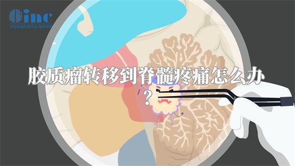 胶质瘤转移到脊髓疼痛怎么办？