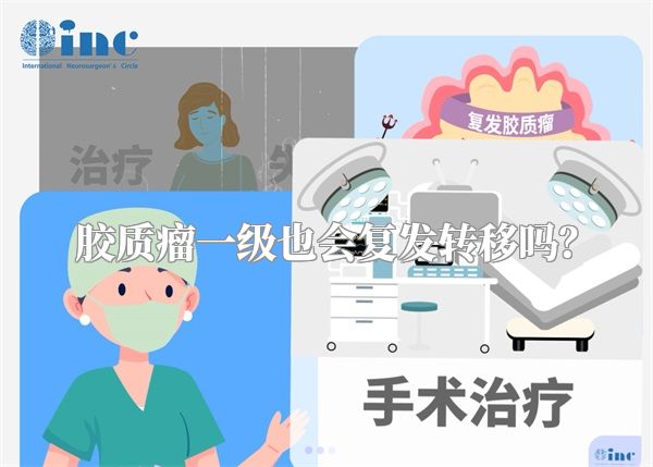 胶质瘤一级也会复发转移吗？