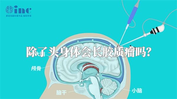 除了头身体会长胶质瘤吗？