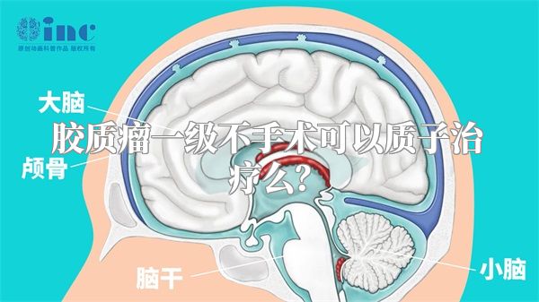 胶质瘤一级不手术可以质子治疗么？