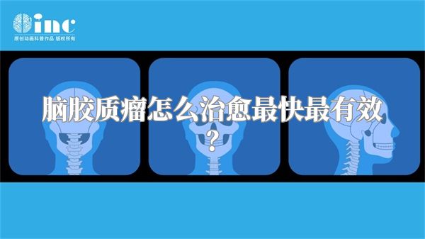 脑胶质瘤怎么治愈最快最有效？