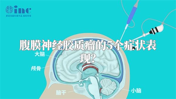 腹膜神经胶质瘤的5个症状表现？