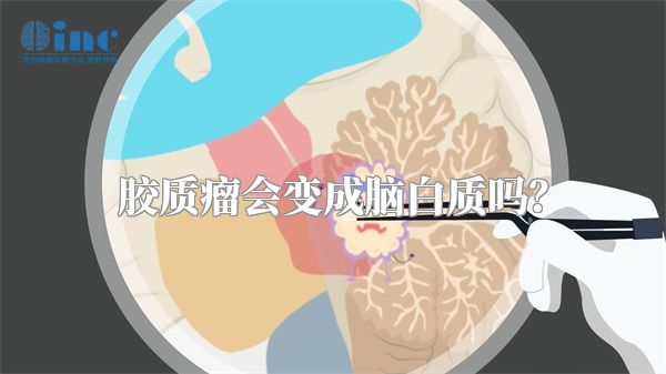 胶质瘤会变成脑白质吗？
