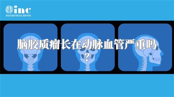 脑胶质瘤长在动脉血管严重吗？