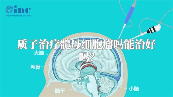 质子治疗髓母细胞瘤吗能治好吗？