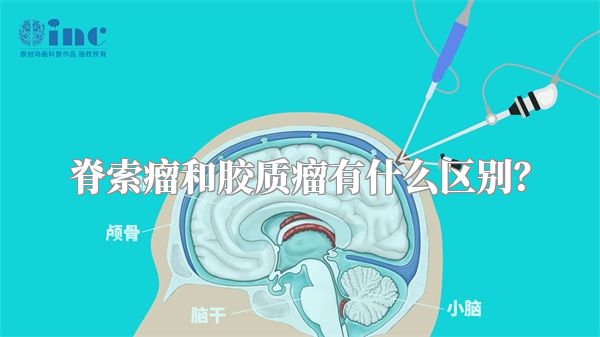 脊索瘤和胶质瘤有什么区别？