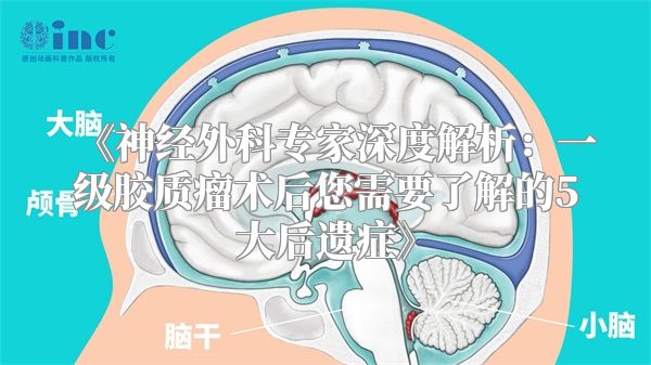 《神经外科专家深度解析：一级胶质瘤术后您需要了解的5大后遗症》