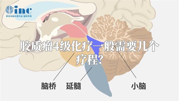 胶质瘤4级化疗一般需要几个疗程？
