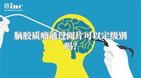 脑胶质瘤通过阅片可以定级别吗？