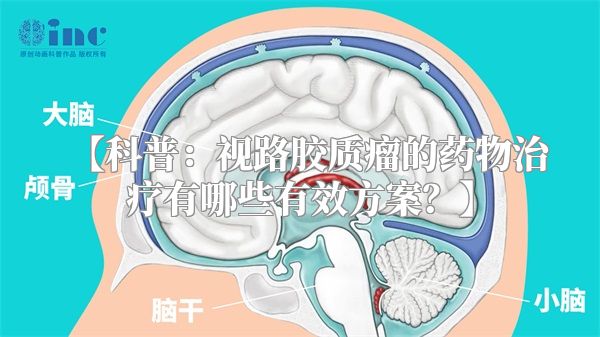 【科普：视路胶质瘤的药物治疗有哪些有效方案？】
