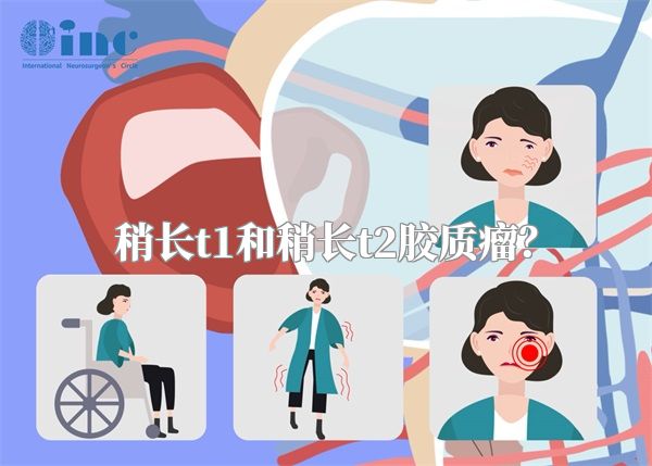 稍长t1和稍长t2胶质瘤？