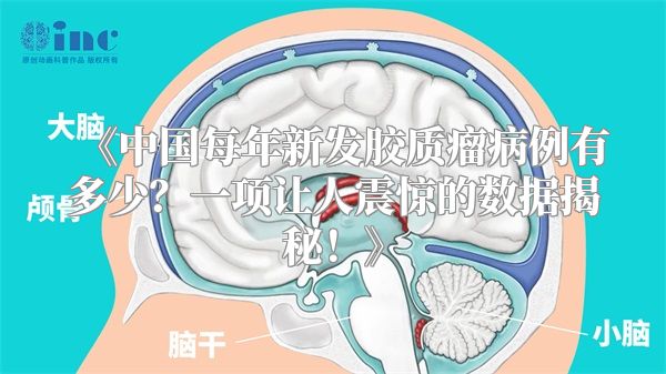 《中国每年新发胶质瘤病例有多少？一项让人震惊的数据揭秘！》
