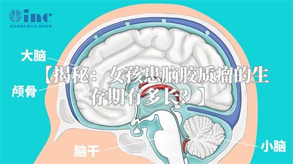 【揭秘：女孩患脑胶质瘤的生存期有多长？】
