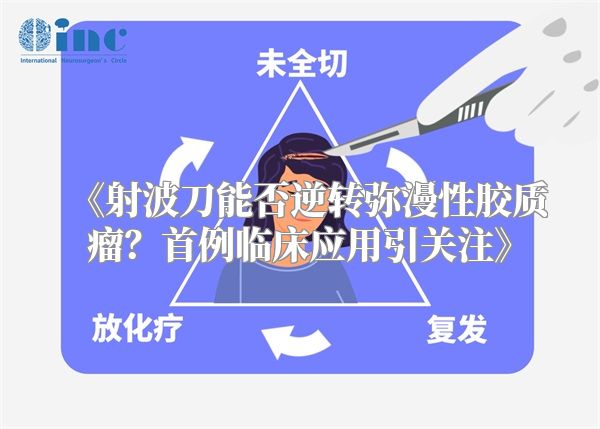 《射波刀能否逆转弥漫性胶质瘤？首例临床应用引关注》