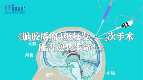 《脑胶质瘤4级复发，二次手术能否逆转生命？》