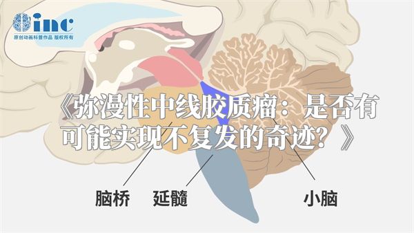 《弥漫性中线胶质瘤：是否有可能实现不复发的奇迹？》