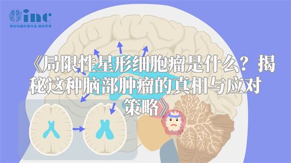 《局限性星形细胞瘤是什么？揭秘这种脑部肿瘤的真相与应对策略》