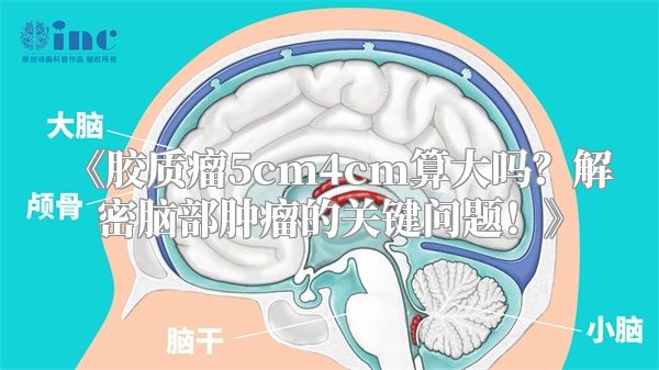 《胶质瘤5cm4cm算大吗？解密脑部肿瘤的关键问题！》