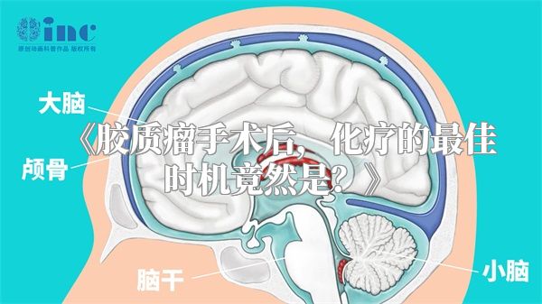 《胶质瘤手术后，化疗的最佳时机竟然是？》