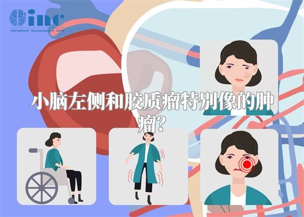 小脑左侧和胶质瘤特别像的肿瘤？