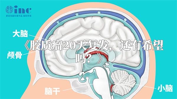 《胶质瘤20天复发，还有希望吗？》