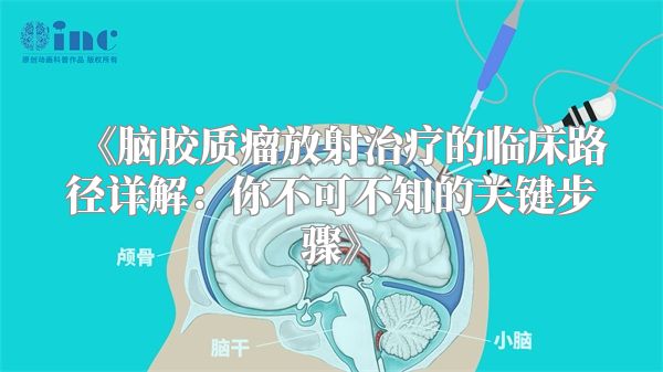 《脑胶质瘤放射治疗的临床路径详解：你不可不知的关键步骤》