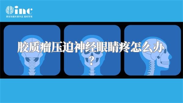 胶质瘤压迫神经眼睛疼怎么办？