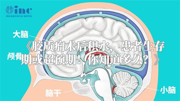 《胶质瘤术后积水，患者生存期或超预期！你知道多久？》