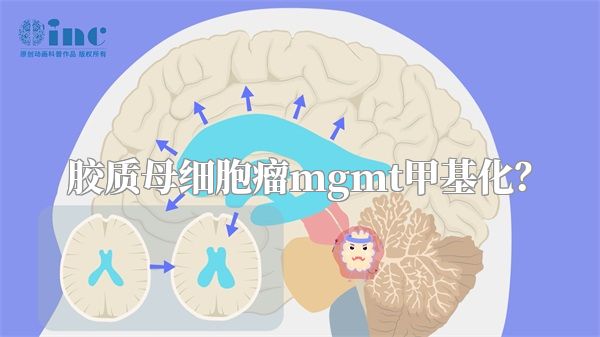 胶质母细胞瘤mgmt甲基化？