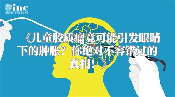 《儿童胶质瘤竟可能引发眼睛下的肿胀？你绝对不容错过的真相！》