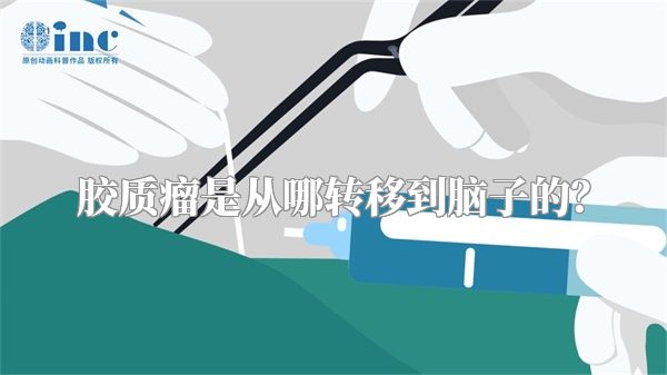 胶质瘤是从哪转移到脑子的？