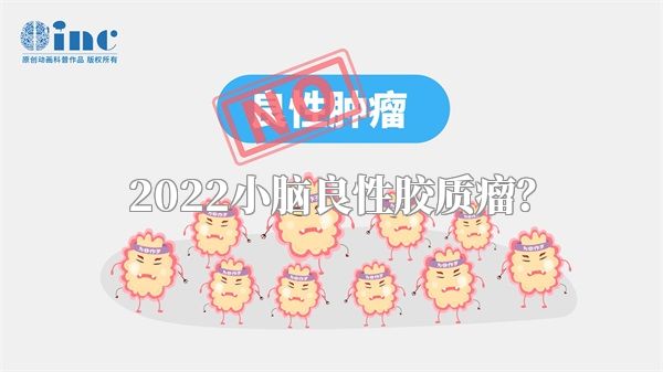 2022小脑良性胶质瘤？