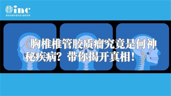 《胸椎椎管胶质瘤究竟是何神秘疾病？带你揭开真相！》