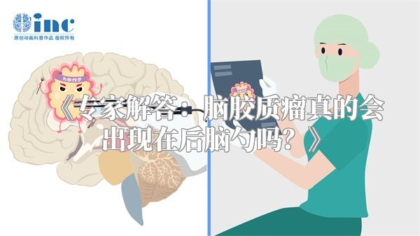 《专家解答：脑胶质瘤真的会出现在后脑勺吗？》