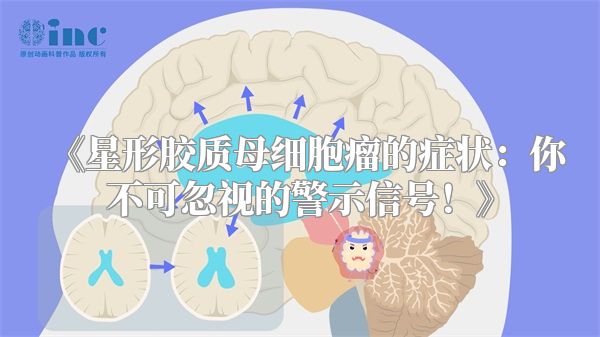 《星形胶质母细胞瘤的症状：你不可忽视的警示信号！》