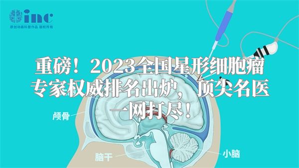 重磅！2023全国星形细胞瘤专家权威排名出炉，顶尖名医一网打尽！