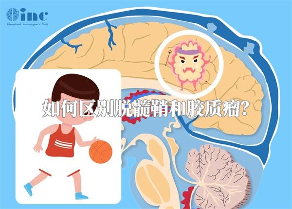 如何区别脱髓鞘和胶质瘤？