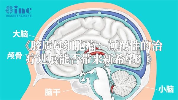 《胶质母细胞瘤：颠覆性的治疗进展能否带来新希望？》