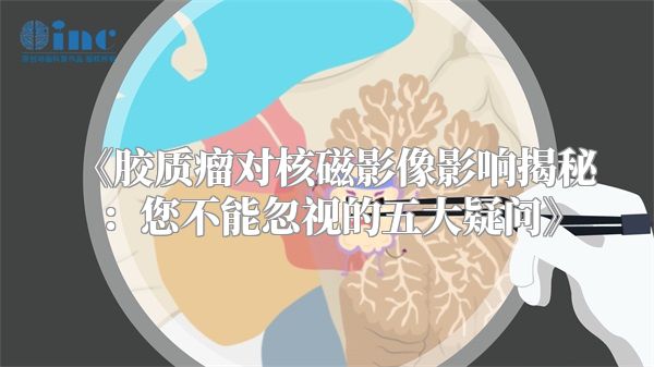 《胶质瘤对核磁影像影响揭秘：您不能忽视的五大疑问》
