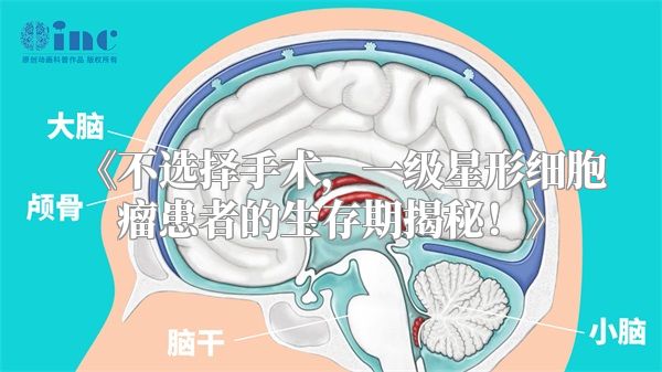《不选择手术，一级星形细胞瘤患者的生存期揭秘！》