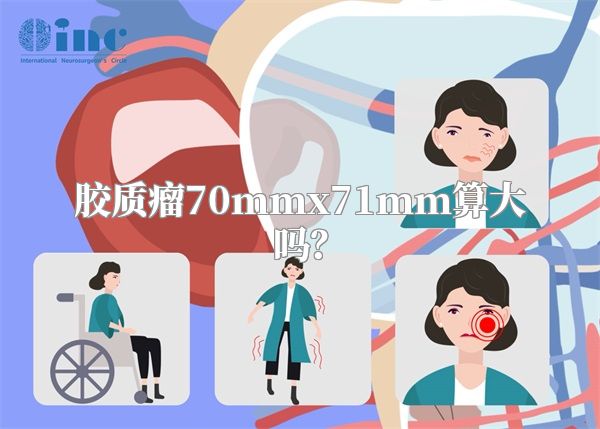 胶质瘤70mmx71mm算大吗？