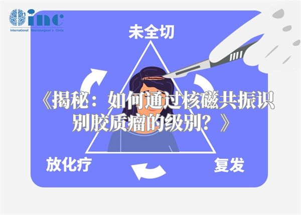 《揭秘：如何通过核磁共振识别胶质瘤的级别？》