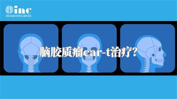 脑胶质瘤car-t治疗？