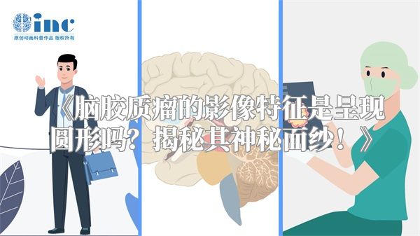 《脑胶质瘤的影像特征是呈现圆形吗？揭秘其神秘面纱！》