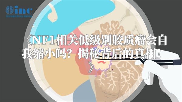 《NF1相关低级别胶质瘤会自我缩小吗？揭秘背后的真相！》