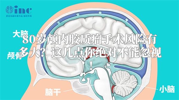 80岁颅内胶质瘤手术风险有多大？这几点你绝对不能忽视！