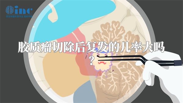 胶质瘤切除后复发的几率大吗？