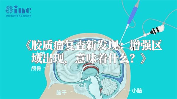《胶质瘤复查新发现：增强区域出现，意味着什么？》