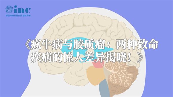 《疯牛病与胶质瘤：两种致命疾病的惊人差异揭晓！》